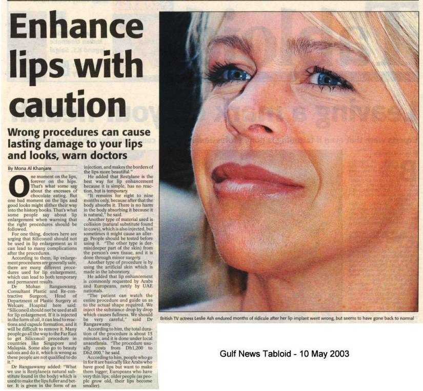 Be Careful with what you put in the lips – Gulf News Tabloid 2003